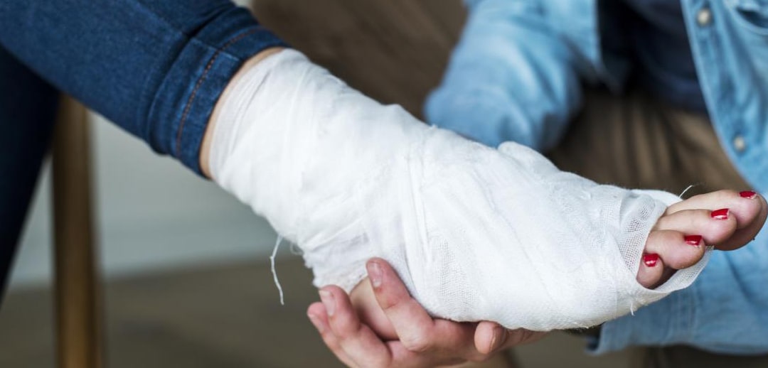 از کجا بفهمیم مچ پامون پیچ خورده؟